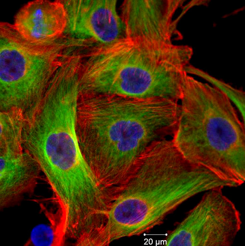 Tackling Tumors With Space Station Research (February2014)